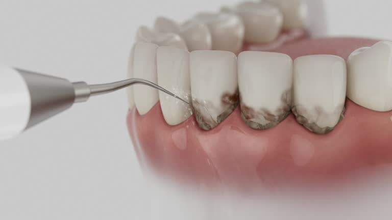 Reliable Tooth Extraction contractor in Wise County County, VA by Dentist Open Now